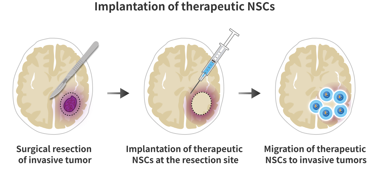 治療用NSCの移植投与