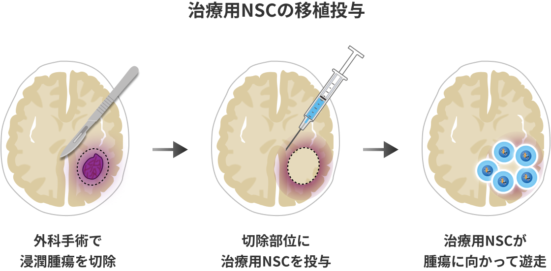 治療用NSCの移植投与